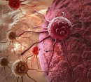 چند  عامل  اصلی  ابتلا  به  سرطان