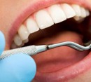 کشف ارتباط خرابی دندان و بیماری قلبی
